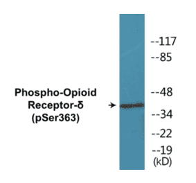 Western Blot - Opioid Receptor delta (phospho Ser363) Cell Based ELISA Kit (CBP1111) - Antibodies.com