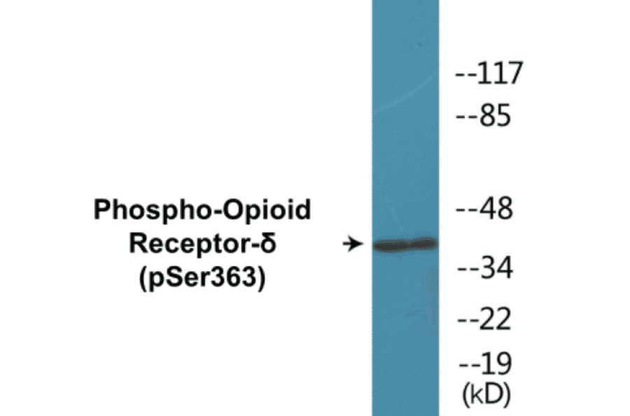 Western Blot - Opioid Receptor delta (phospho Ser363) Cell Based ELISA Kit (CBP1111) - Antibodies.com