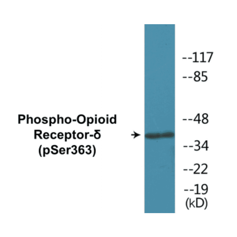 Western Blot - Opioid Receptor delta (phospho Ser363) Cell Based ELISA Kit (CBP1111) - Antibodies.com