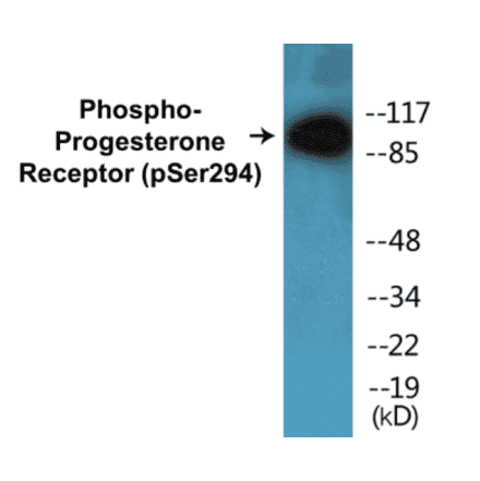 Western Blot - Progesterone Receptor (phospho Ser294) Cell Based ELISA Kit (CBP1207) - Antibodies.com