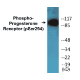 Western Blot - Progesterone Receptor (phospho Ser294) Cell Based ELISA Kit (CBP1207) - Antibodies.com