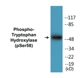 Western Blot - Tryptophan Hydroxylase (phospho Ser58) Cell Based ELISA Kit (CBP1399) - Antibodies.com