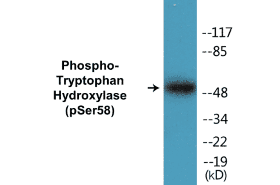Western Blot - Tryptophan Hydroxylase (phospho Ser58) Cell Based ELISA Kit (CBP1399) - Antibodies.com