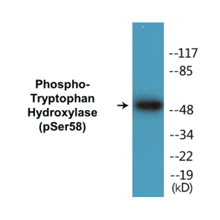 Western Blot - Tryptophan Hydroxylase (phospho Ser58) Cell Based ELISA Kit (CBP1399) - Antibodies.com