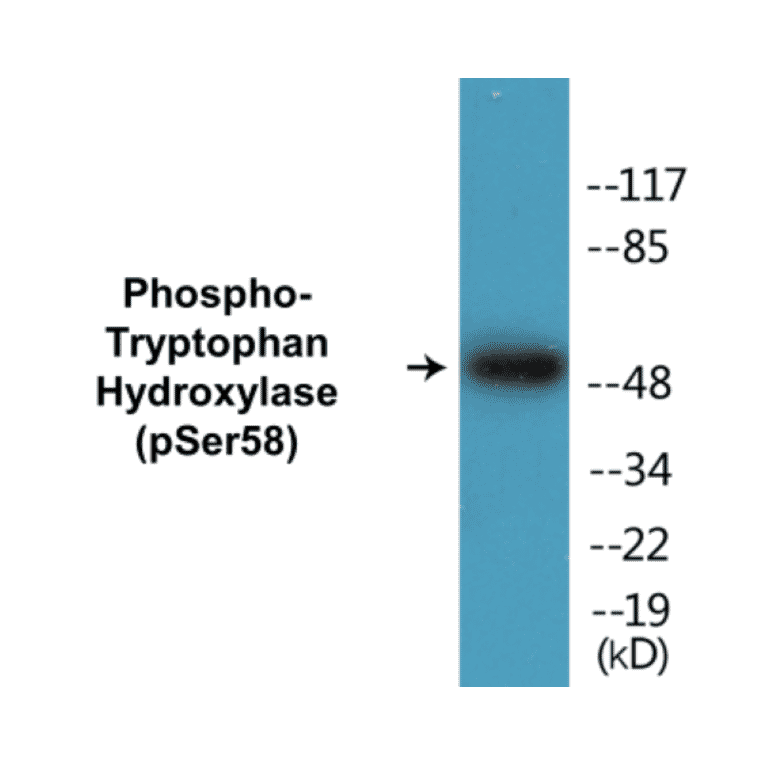 Western Blot - Tryptophan Hydroxylase (phospho Ser58) Cell Based ELISA Kit (CBP1399) - Antibodies.com