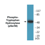 Western Blot - Tryptophan Hydroxylase (phospho Ser58) Cell Based ELISA Kit (CBP1399) - Antibodies.com