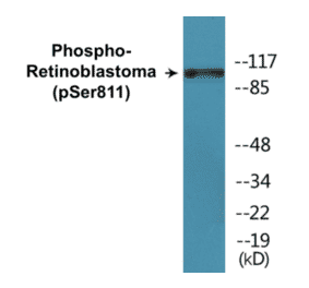 Western Blot - Retinoblastoma (phospho Ser811) Cell Based ELISA Kit (CBP1315) - Antibodies.com