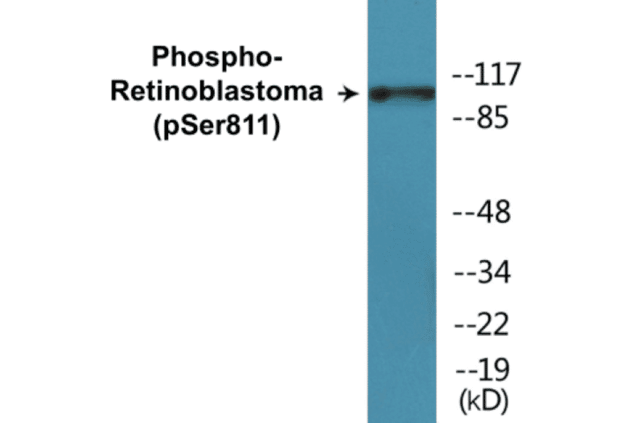 Western Blot - Retinoblastoma (phospho Ser811) Cell Based ELISA Kit (CBP1315) - Antibodies.com