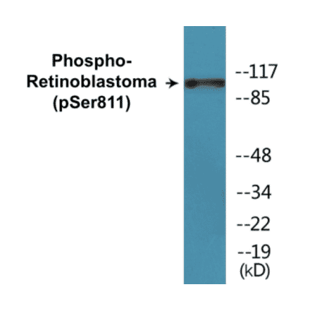 Western Blot - Retinoblastoma (phospho Ser811) Cell Based ELISA Kit (CBP1315) - Antibodies.com