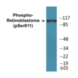 Western Blot - Retinoblastoma (phospho Ser811) Cell Based ELISA Kit (CBP1315) - Antibodies.com