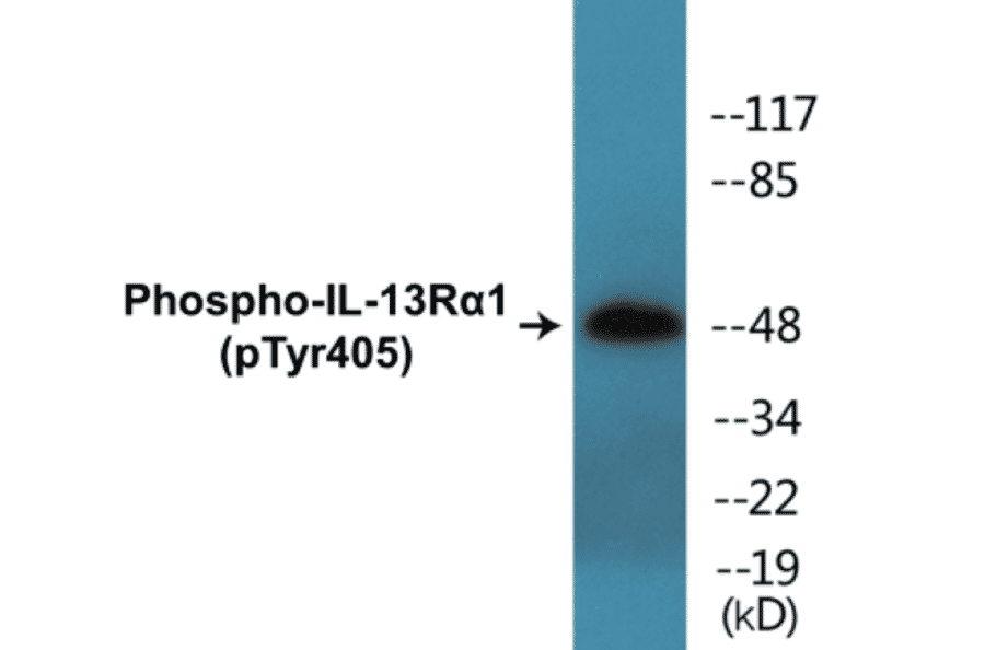 Western Blot - IL-13R alpha 1 (phospho Tyr405) Cell Based ELISA Kit (CBP1416) - Antibodies.com