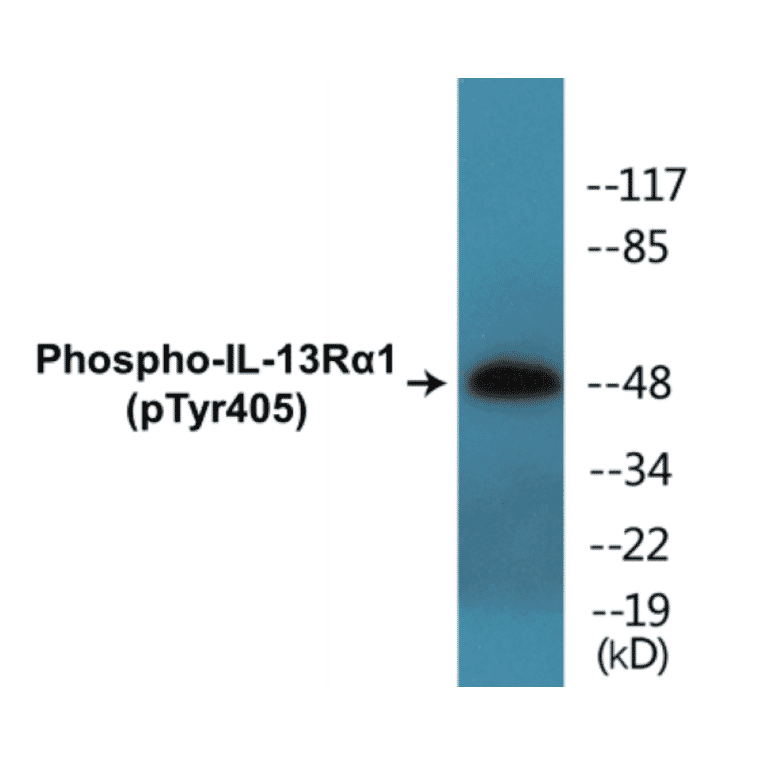 Western Blot - IL-13R alpha 1 (phospho Tyr405) Cell Based ELISA Kit (CBP1416) - Antibodies.com