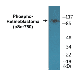 Western Blot - Retinoblastoma (phospho Ser780) Cell Based ELISA Kit (CBP1665) - Antibodies.com