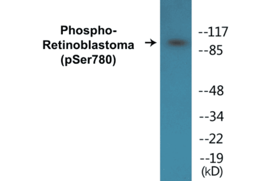 Western Blot - Retinoblastoma (phospho Ser780) Cell Based ELISA Kit (CBP1665) - Antibodies.com