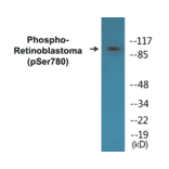 Western Blot - Retinoblastoma (phospho Ser780) Cell Based ELISA Kit (CBP1665) - Antibodies.com