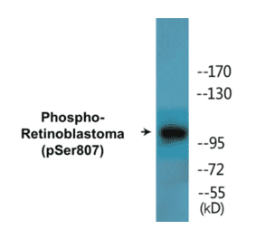 Western Blot - Retinoblastoma (phospho Ser807) Cell Based ELISA Kit (CBP1667) - Antibodies.com