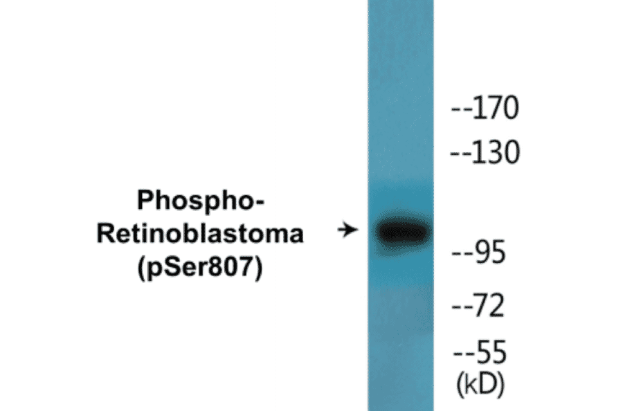 Western Blot - Retinoblastoma (phospho Ser807) Cell Based ELISA Kit (CBP1667) - Antibodies.com