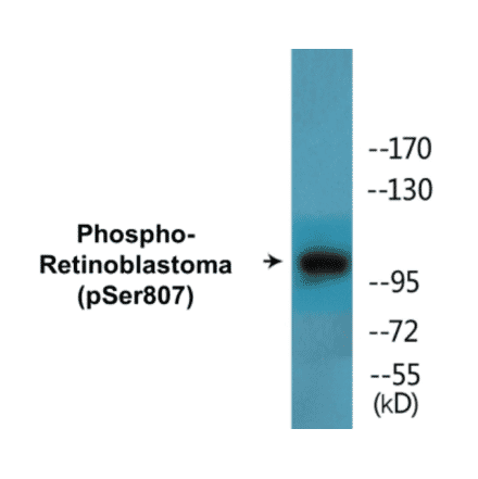 Western Blot - Retinoblastoma (phospho Ser807) Cell Based ELISA Kit (CBP1667) - Antibodies.com