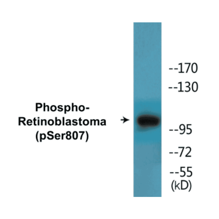 Western Blot - Retinoblastoma (phospho Ser807) Cell Based ELISA Kit (CBP1667) - Antibodies.com