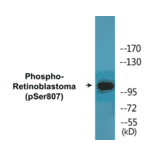 Western Blot - Retinoblastoma (phospho Ser807) Cell Based ELISA Kit (CBP1667) - Antibodies.com