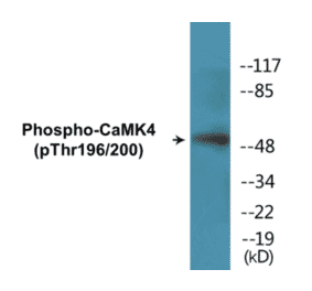 Western Blot - CaMK4 (phospho Thr196 + Thr200) Cell Based ELISA Kit (CBP1329) - Antibodies.com