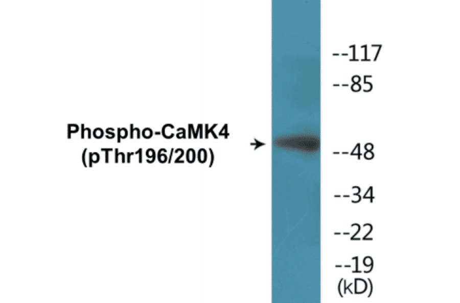 Western Blot - CaMK4 (phospho Thr196 + Thr200) Cell Based ELISA Kit (CBP1329) - Antibodies.com