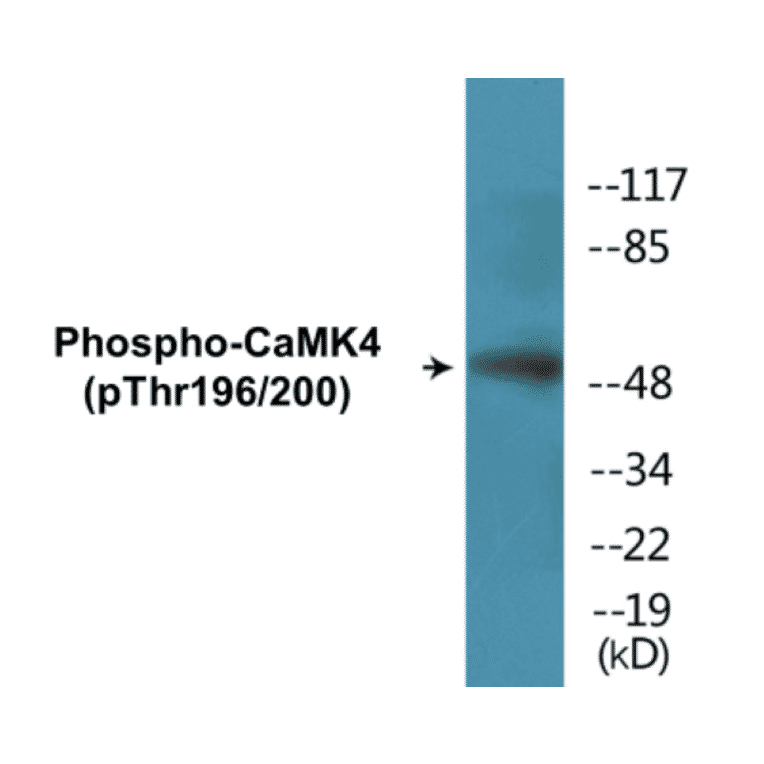 Western Blot - CaMK4 (phospho Thr196 + Thr200) Cell Based ELISA Kit (CBP1329) - Antibodies.com