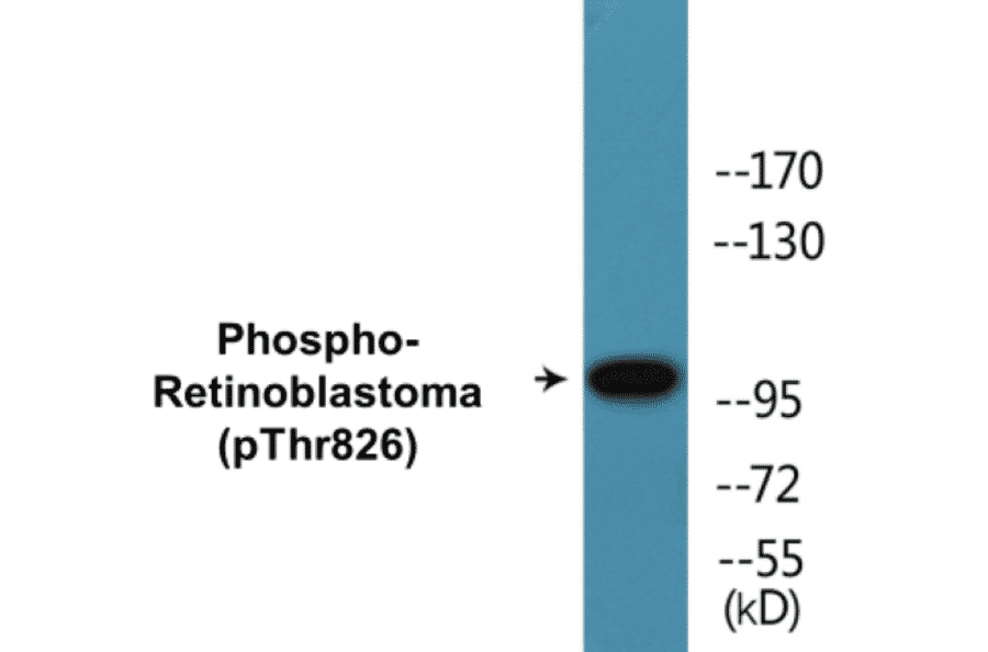 Western Blot - Retinoblastoma (phospho Thr826) Cell Based ELISA Kit (CBP1389) - Antibodies.com