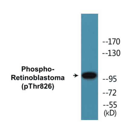Western Blot - Retinoblastoma (phospho Thr826) Cell Based ELISA Kit (CBP1389) - Antibodies.com