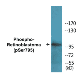 Western Blot - Retinoblastoma (phospho Ser795) Cell Based ELISA Kit (CBP1666) - Antibodies.com