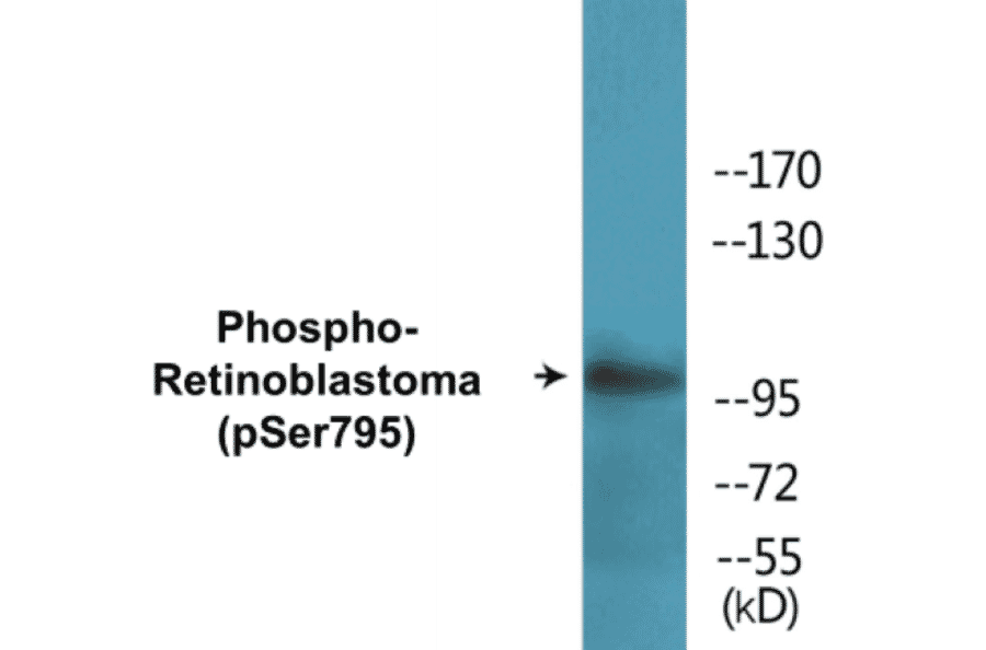 Western Blot - Retinoblastoma (phospho Ser795) Cell Based ELISA Kit (CBP1666) - Antibodies.com