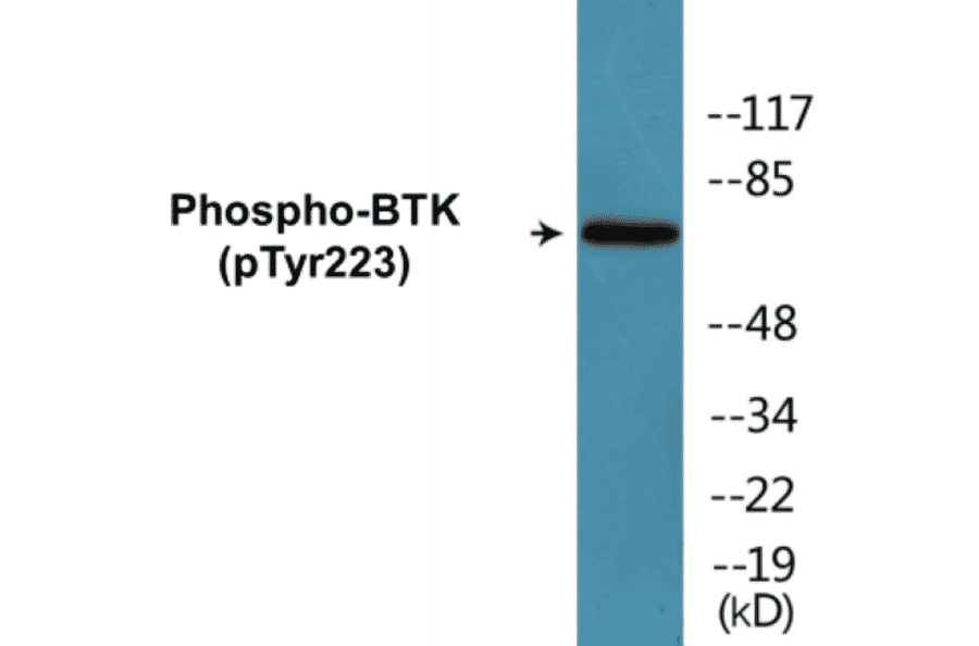 Western Blot - BTK (phospho Tyr223) Cell Based ELISA Kit (CBP1047) - Antibodies.com