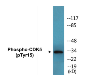 Western Blot - CDK5 (phospho Tyr15) Cell Based ELISA Kit (CBP1446) - Antibodies.com