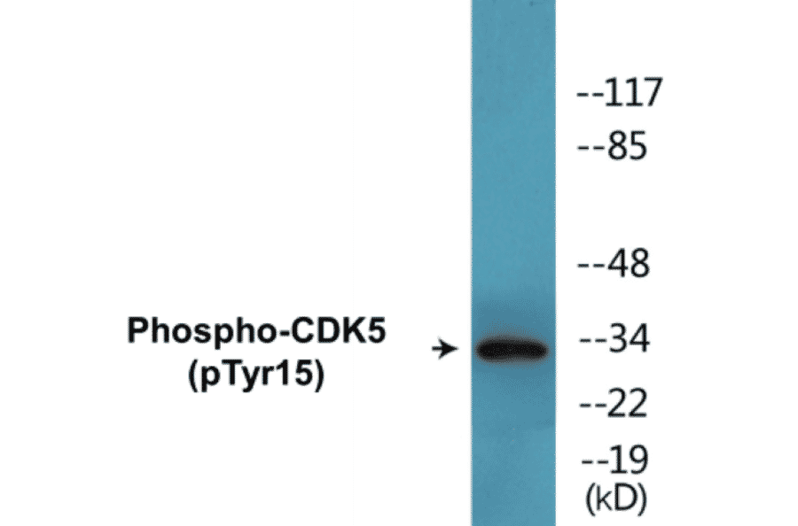 Western Blot - CDK5 (phospho Tyr15) Cell Based ELISA Kit (CBP1446) - Antibodies.com