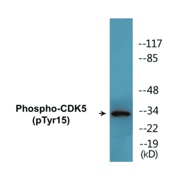 Western Blot - CDK5 (phospho Tyr15) Cell Based ELISA Kit (CBP1446) - Antibodies.com