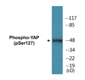 Western Blot - YAP (phospho Ser127) Cell Based ELISA Kit (CBP1283) - Antibodies.com