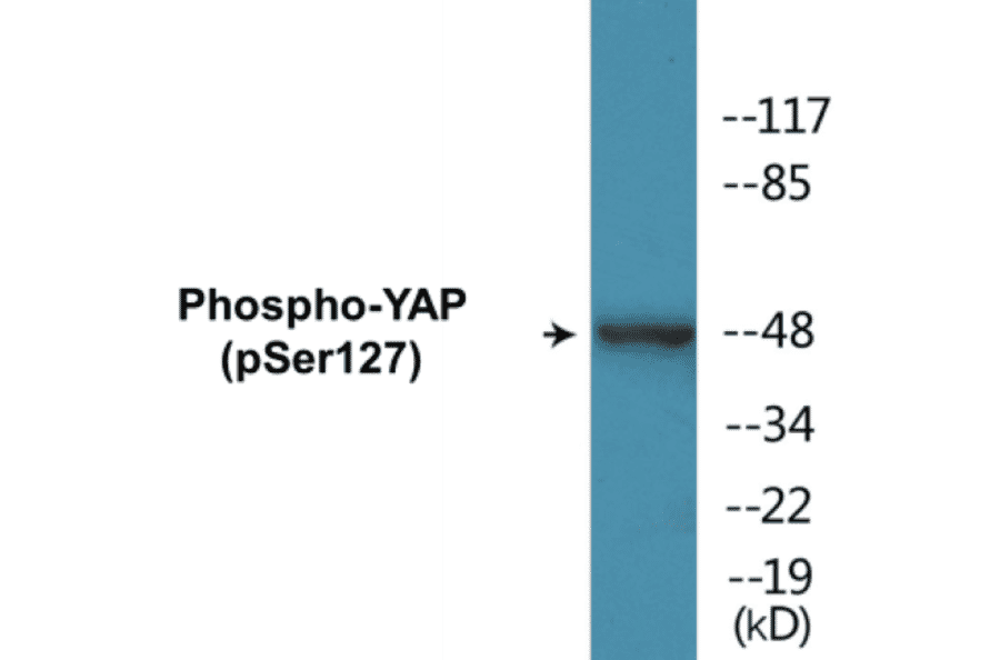 Western Blot - YAP (phospho Ser127) Cell Based ELISA Kit (CBP1283) - Antibodies.com