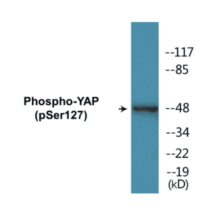 Western Blot - YAP (phospho Ser127) Cell Based ELISA Kit (CBP1283) - Antibodies.com