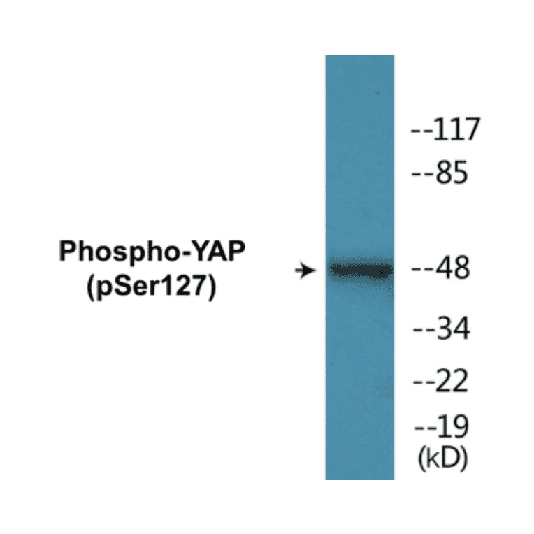 Western Blot - YAP (phospho Ser127) Cell Based ELISA Kit (CBP1283) - Antibodies.com
