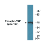 Western Blot - YAP (phospho Ser127) Cell Based ELISA Kit (CBP1283) - Antibodies.com