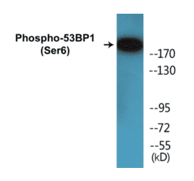 Western Blot - 53BP1 (phospho Ser6) Cell Based ELISA Kit (CBP1286) - Antibodies.com