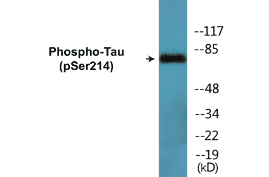 Western Blot - Tau (phospho Ser214) Cell Based ELISA Kit (CBP1693) - Antibodies.com