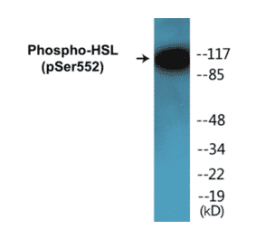 Western Blot - HSL (phospho Ser552) Cell Based ELISA Kit (CBP1124) - Antibodies.com