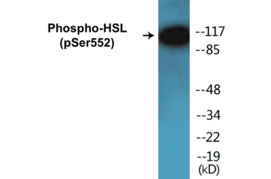 Western Blot - HSL (phospho Ser552) Cell Based ELISA Kit (CBP1124) - Antibodies.com