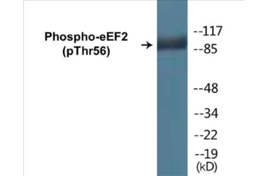 Western Blot - eEF2 (phospho Thr56) Cell Based ELISA Kit (CBP1063) - Antibodies.com