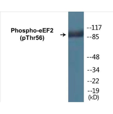 Western Blot - eEF2 (phospho Thr56) Cell Based ELISA Kit (CBP1063) - Antibodies.com