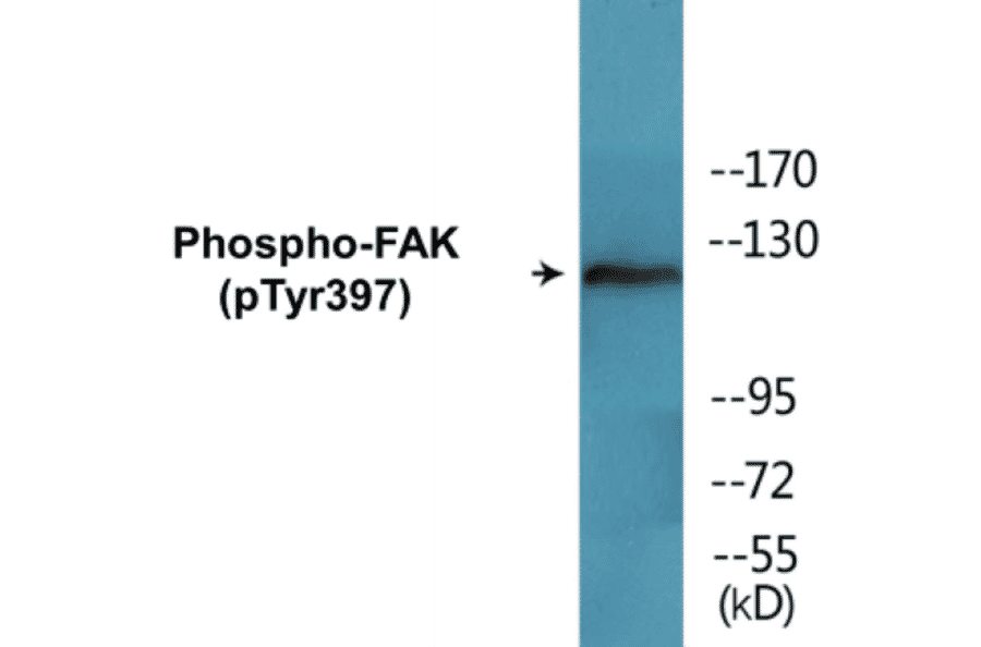 Western Blot - FAK (phospho Tyr397) Cell Based ELISA Kit (CBP1552) - Antibodies.com
