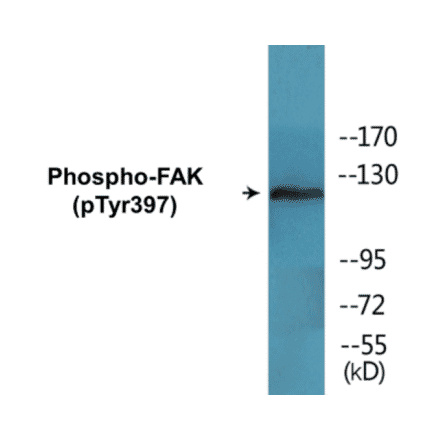 Western Blot - FAK (phospho Tyr397) Cell Based ELISA Kit (CBP1552) - Antibodies.com