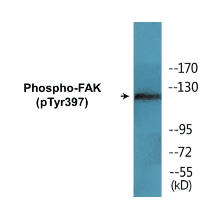 Western Blot - FAK (phospho Tyr397) Cell Based ELISA Kit (CBP1552) - Antibodies.com