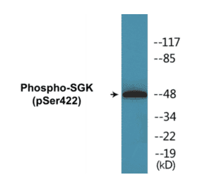 Western Blot - SGK (phospho Ser422) Cell Based ELISA Kit (CBP1080) - Antibodies.com